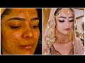How to correct Acne Skin tutorial | Farah’s beauty salon |
