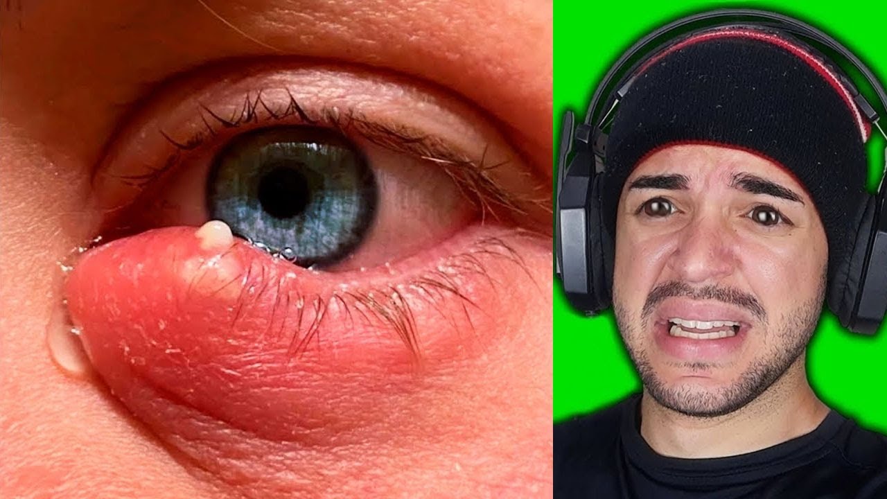 se você terminar este vídeo você ganha R$ 10.000