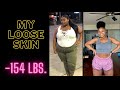 I LOST 154 POUNDS NATURALLY, DO I HAVE LOOSE SKIN? The Truth About Loose Skin