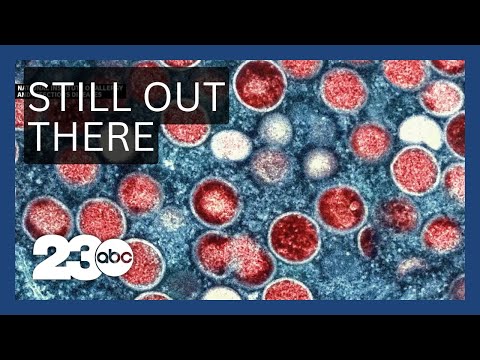 Mpox Cases Rising in US: CDC Warns of Vaccinated Infections