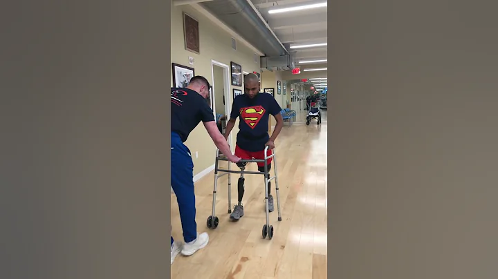 Bilateral Above knee with #ottobockx3s