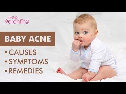 Video: What To Do If A Baby Has Small Red Pimples On Her Face