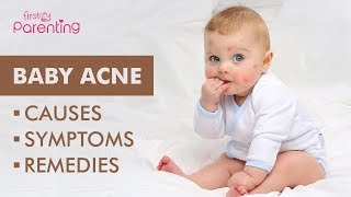 Baby Acne – Causes, Symptoms & Treatment