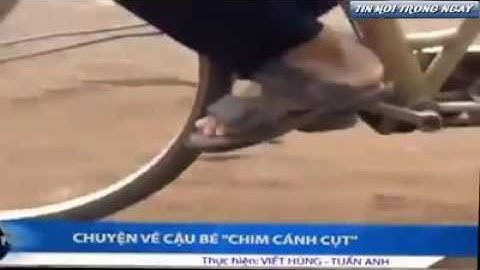 Cậu bé "chim cánh cụt"