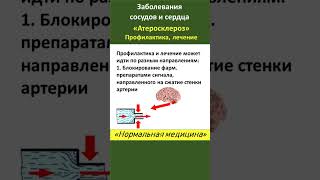 Что в профилактике и лечении Атеросклероза правда, а что нет?