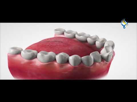 فيديو: علاقة الأسنان بالأعضاء الداخلية
