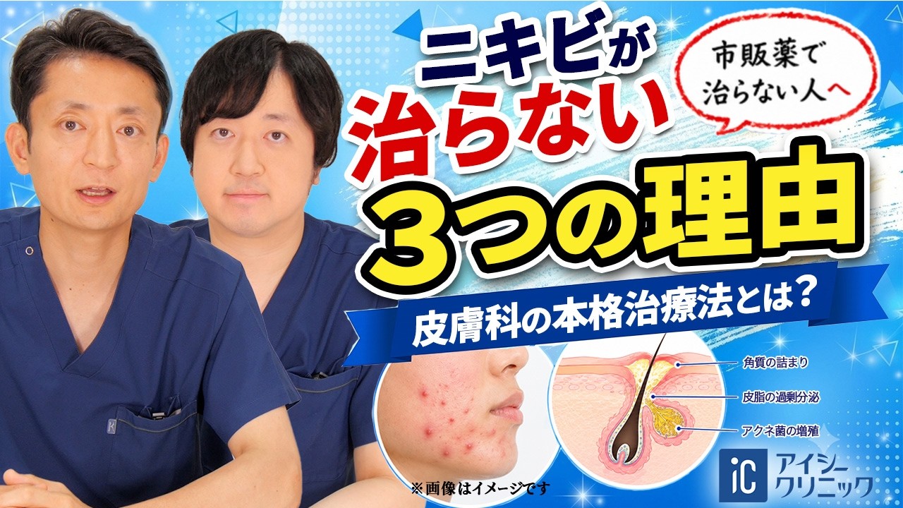 ロキシ スロ マイシン ニキビ