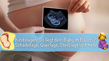 Was bedeutet SL Lage in der Schwangerschaft?