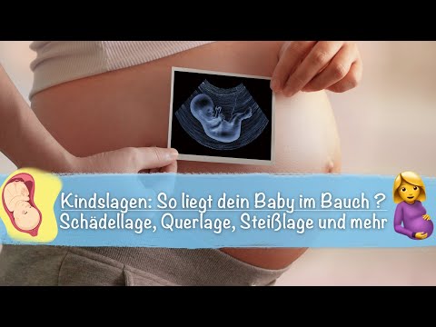 Video: Wie Das Baby Im Bauch Liegt