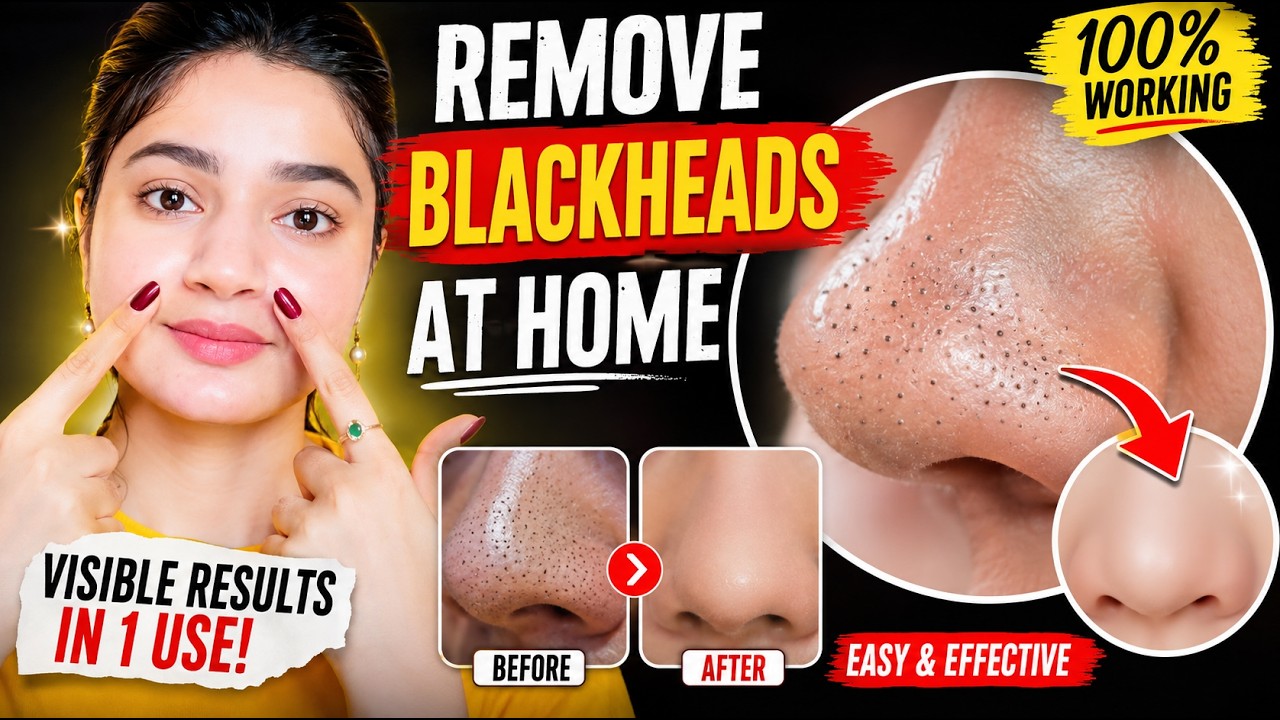 BEST WAY TO REMOVE BLACKHEADS AT HOME | - YouTube