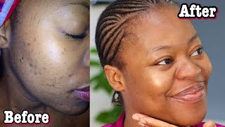 MY SECRET TO HEALTHY GLOWING SKIN  | SKINCARE ROUTINE | ACHIEVING CLEAR BRIGHT  "GLASS SKIN" screenshot 4