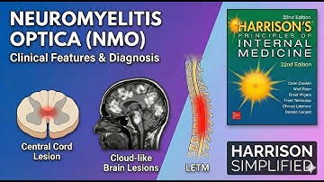 Neuromyelitis Optica (Part 2): Clinical Features and Diagnosis | Harrison Simplified