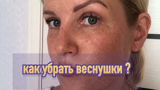 Как убрать веснушки быстро?Эти продукты есть у каждой хозяйке!