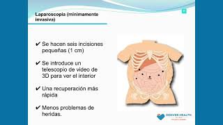 Seminario virtual sobre el Centro de Cirugía Bariatrica de Denver Health