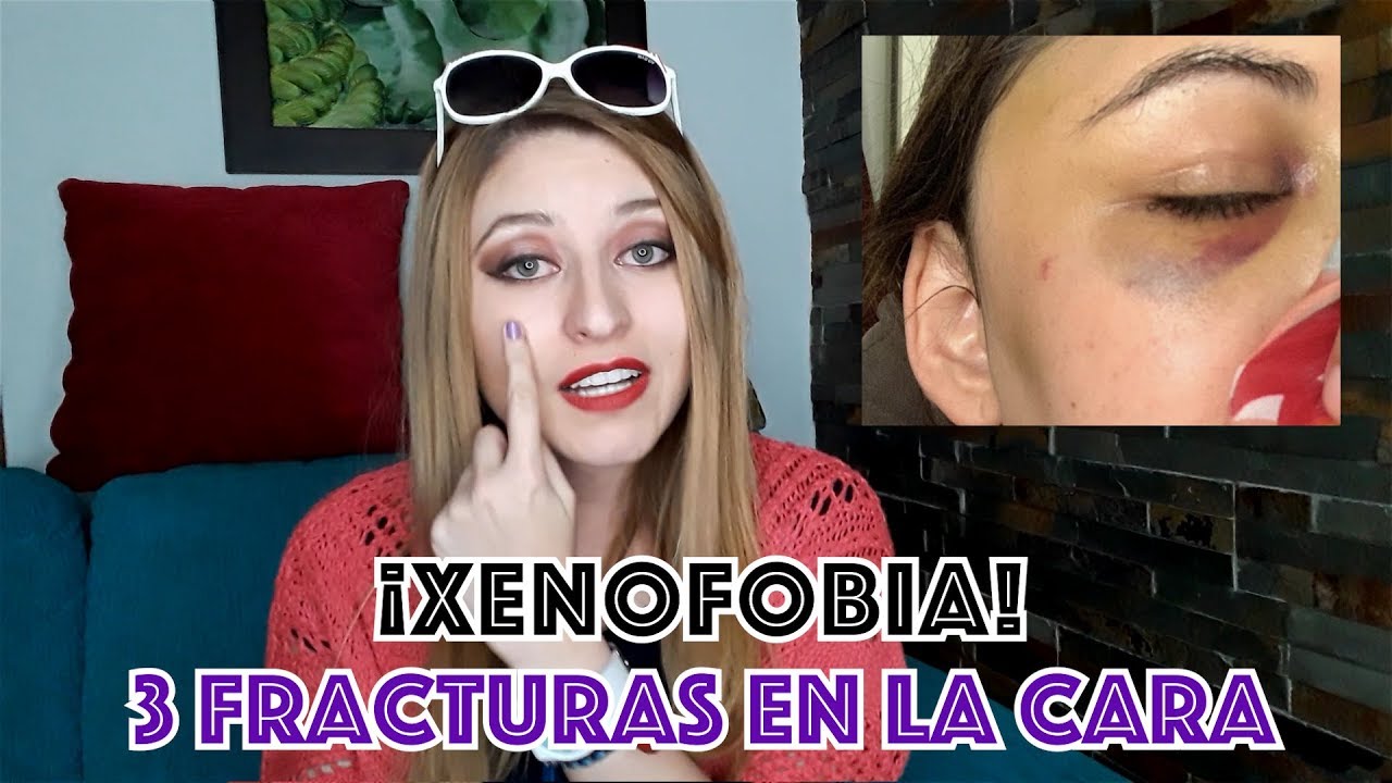 ¡XENOFOBIA! Golpearon a una amiga en Nueza Zelanda / PAPS 