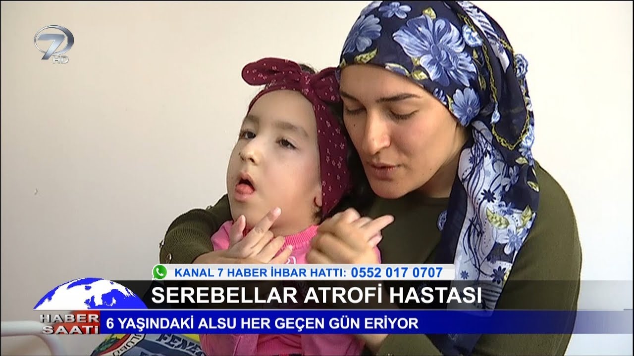Serebellar Atrofi Hastası 6 Yaşındaki Alsu Her Geçen Gün Eriyor.