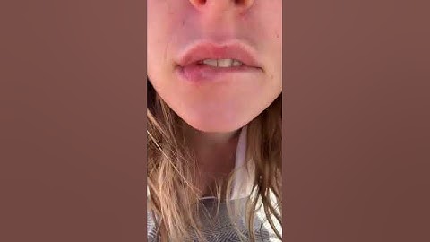 Thumbnail of Kiss triggers ✨