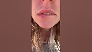 Thumbnail of Kiss triggers ✨