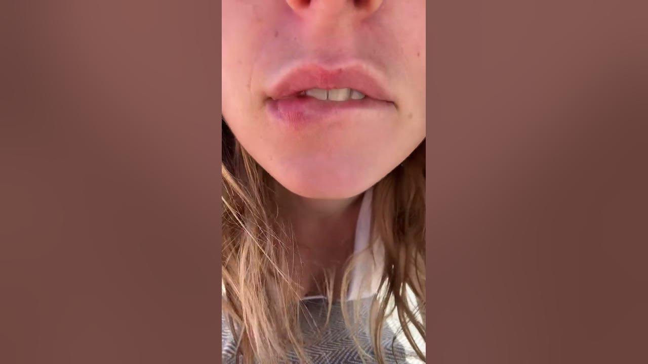 Kiss triggers ✨