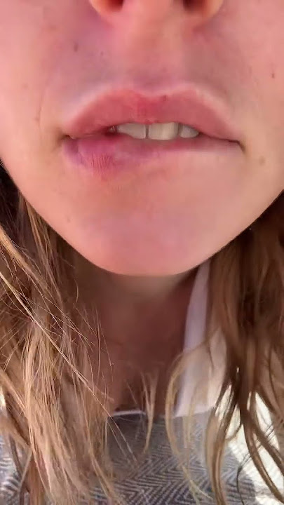 Kiss triggers ✨