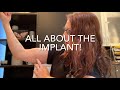 37) All About the Implant! (Talking LARC With Dr. D,  @dr_dervaitis)