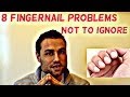 8 Fingernail Problems Not To Ignore