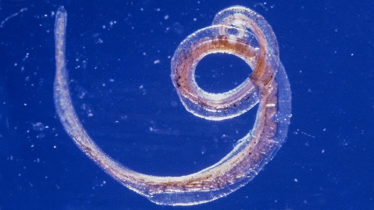 Круглые черви заболевания. Власоглав геогельминт. Власоглав человеческий (Trichocephalus Trichiurus). Трихоцефалез – власоглав. Круглые черви паразиты власоглав.