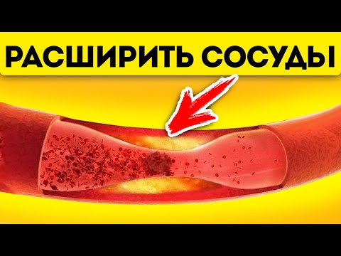 Почему сосуды сужаются? Как можно предотвратить сужение сосудов головного мозга