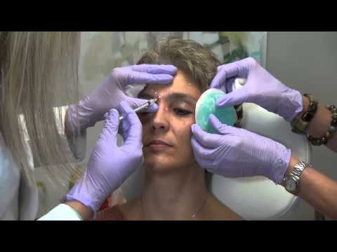 Video: Hoe Botox Is Uitgevonden
