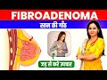 All about fibroadenoma diet and ayurvedic treatment  lumps treatment      