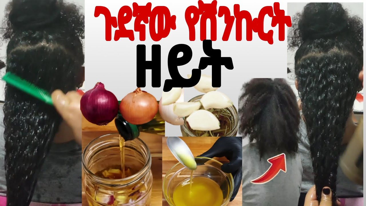 ጉደኛው የሽንኩርት ዘይት የተጎዳ ፀጉር ለሚሰባበር ለሚነቃቀል ከግንባር ላይ ለሸሸ (onion oil forhair growth 