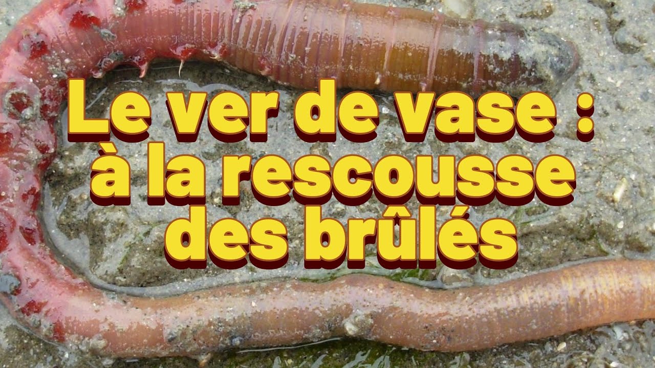 Comment un Ver de Vase Guérit les Grands Brûlés ?