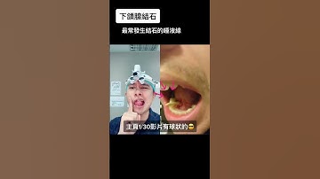 與 @thebentist  #合拍  沒錯又是下頜腺結石，另外一種球型的石頭比較常見（1:30拍過喔 看主頁）#sialoadenitis  #sialolithiasis  #shorts