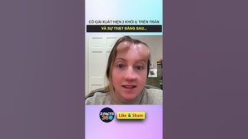 Cô gái xuất hiện 2 khối u mọc trên trán và sự thật đằng sau #shorts