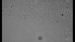 Fish Scale Keratocytes -- Tissue and Cell Motility
