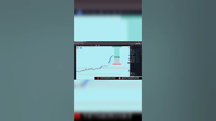 Trading Rules Setup | The Trader Choice #shorts  #trading #stockmarket #optionstrading  #scalping