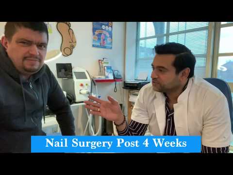 5 weeks post nail surgery! - Abid Hussain Podiatrist