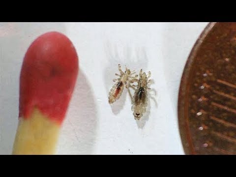 So wirst du Läuse auf natürliche Weise los!