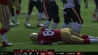 Madden 25 Concussion injury?
