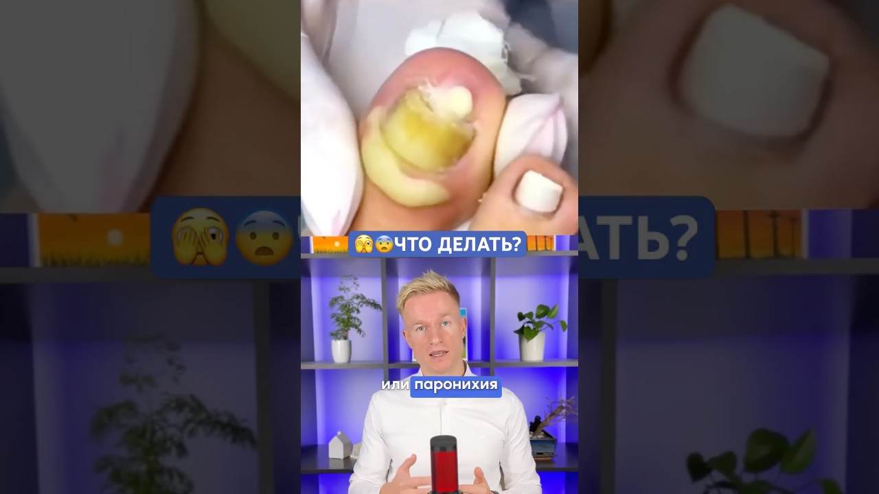 🦠ПАРОНИХИЯ, ЧТО ЭТО? - помощь при воспалении ногтя #подолог #подология #ноготь #ногти #гнойный #топ