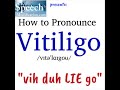 How to Pronounce Vitiligo