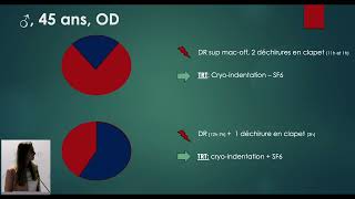 Scrv 2023 16 Cerclage Sur 360 - Dr Soffren I.