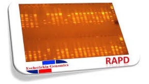 Molecular Markers/RAPD/SSR/RFLP