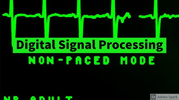 DSP L12 - Finding DFT using Linear Transformation
