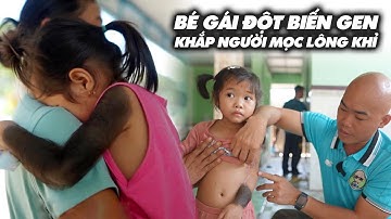 CHUYỆN LẠ BÉ GÁI MỘC LÔNG NHƯ KHỈ ĐÃ CÓ KẾT QUẢ PHẨU THUẬT THÀNH CÔNG