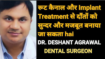Dental diseases are now easily treated, RCT and IMPLANT treatments have also become simpler... Dr. Deshant Agarwal 