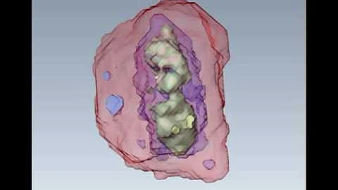 Structures in the nucleus of a mouse's nerve cell