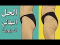 السيلوليت | أسباب لايذكرها الأطباء وعلاجه مع الدكتور بيرج - احتباس السوائل