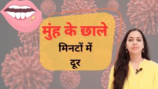 मुंह के छालों का पक्का इलाज | Cure Mouth Ulcers Naturally & Permanently