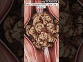 Why Constipated Stool Looks Like Pebbles | Gut Health | Body Arts Anatomy 3D
